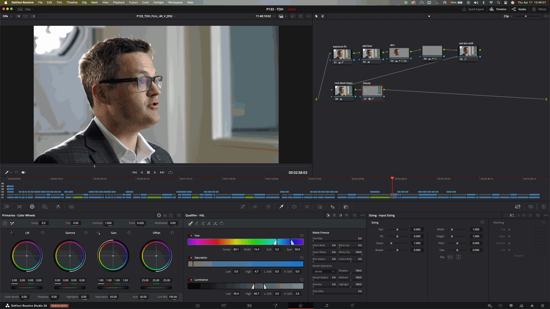 screenshot of a color grade by mainspring agency on a project for the ottawa hospital